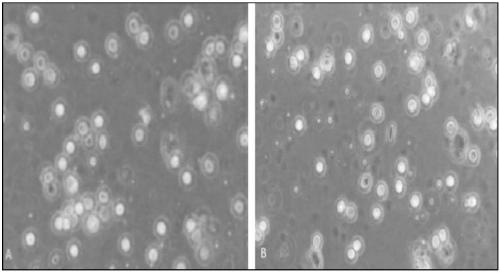 Preparation method of placental hematopoietic stem cells