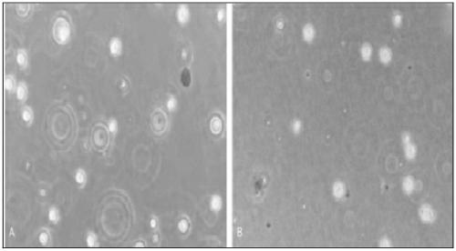 Preparation method of placental hematopoietic stem cells