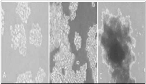 Preparation method of placental hematopoietic stem cells