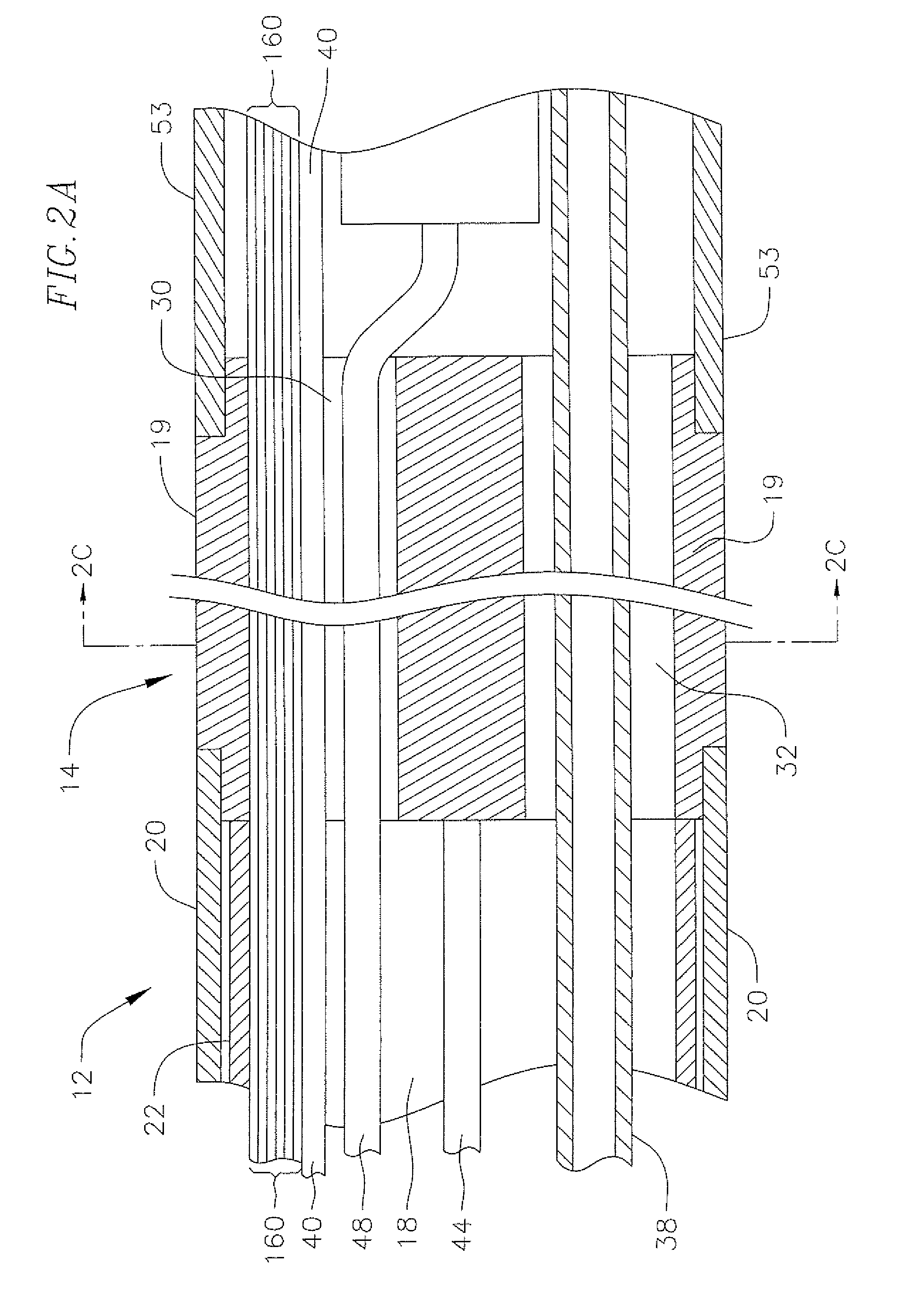 Catheter having a force sensing distal tip