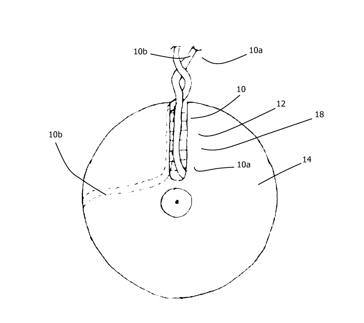 Device for enabling a non-integer number of windings to be provided on an inductor