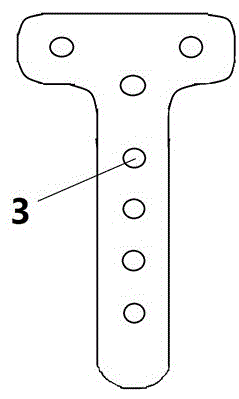 Orthopaedic tibia bone fracture plate