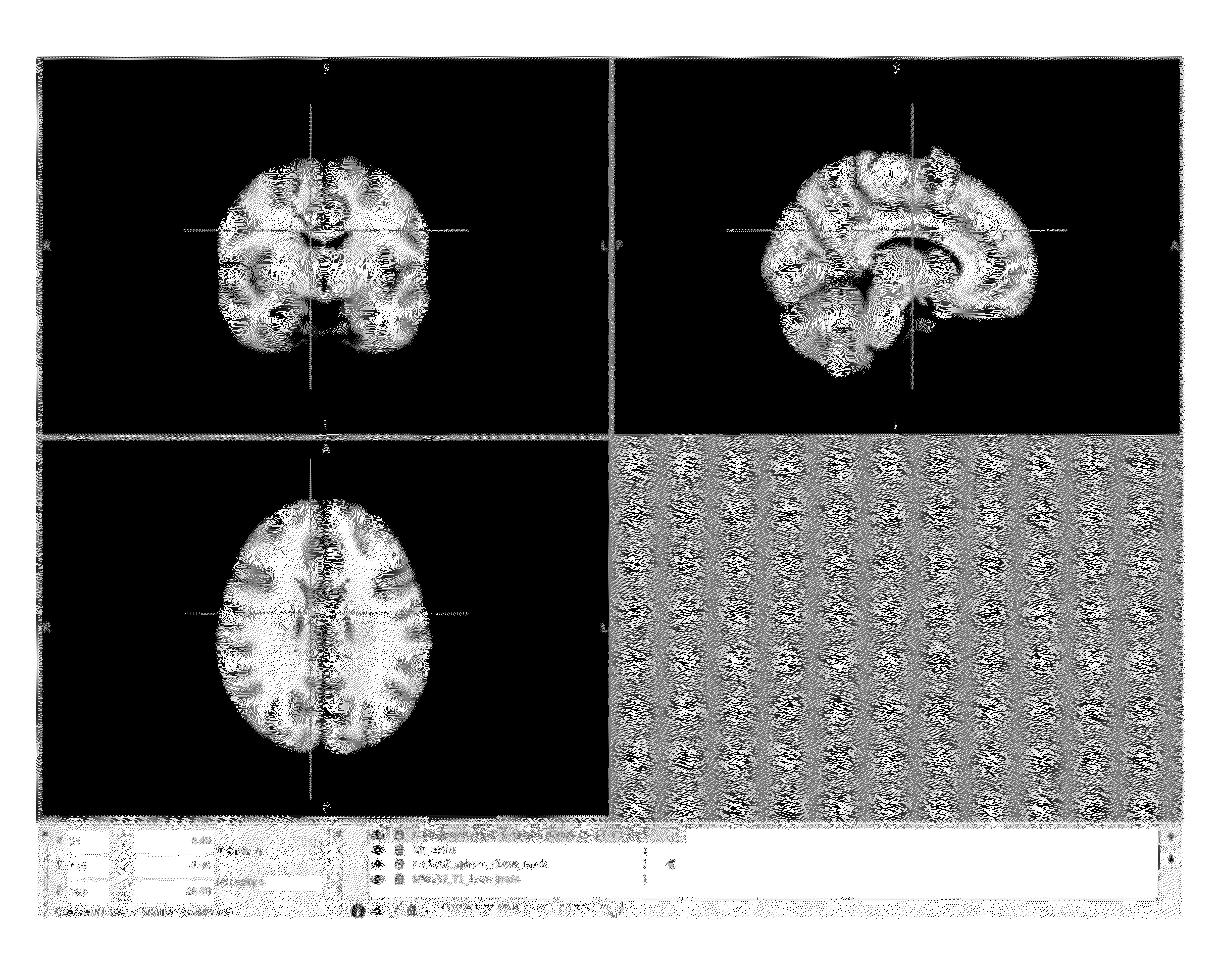 Method for changing an individual's state of consciousness