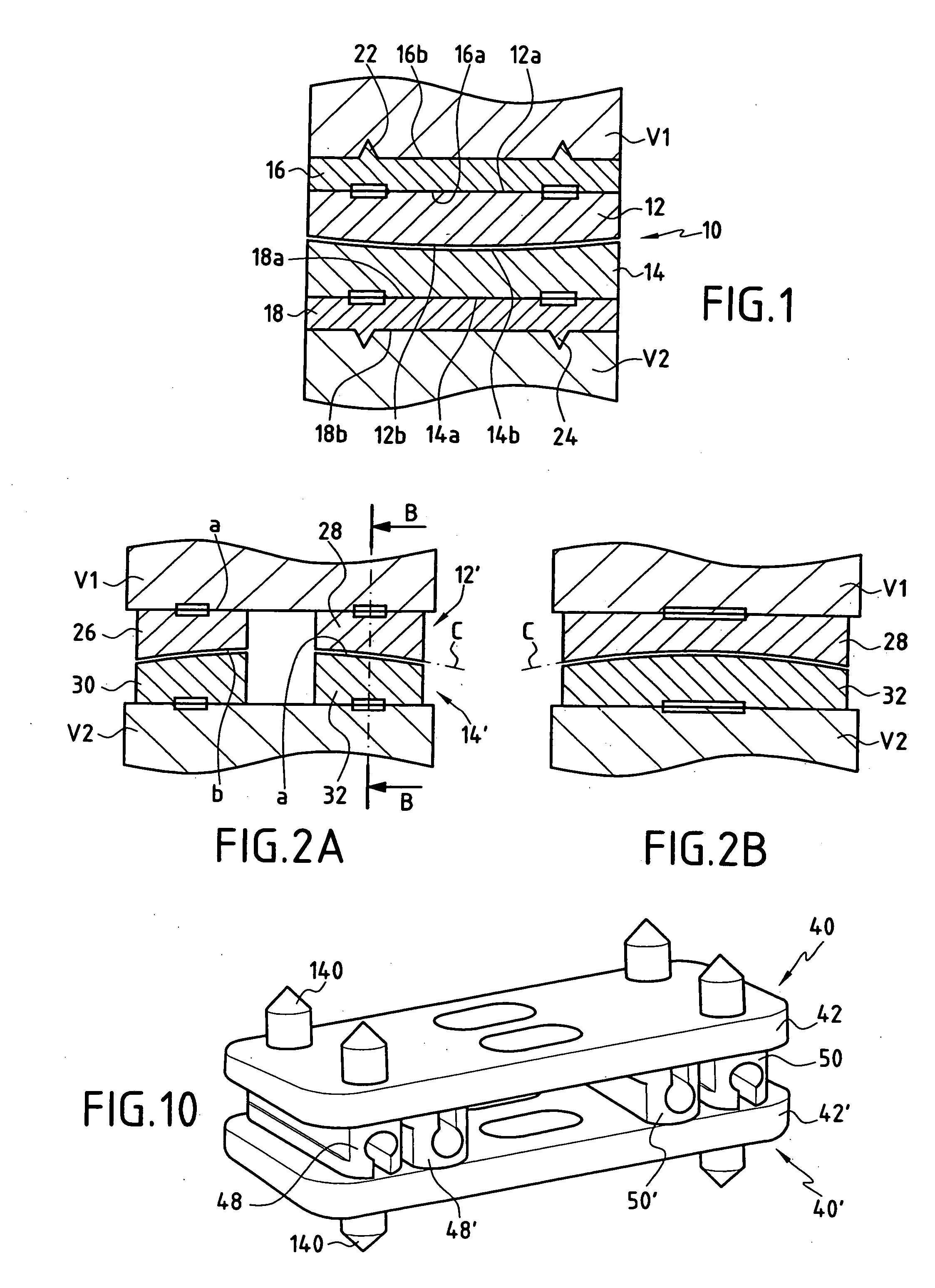 Intervertebral disk prosthesis