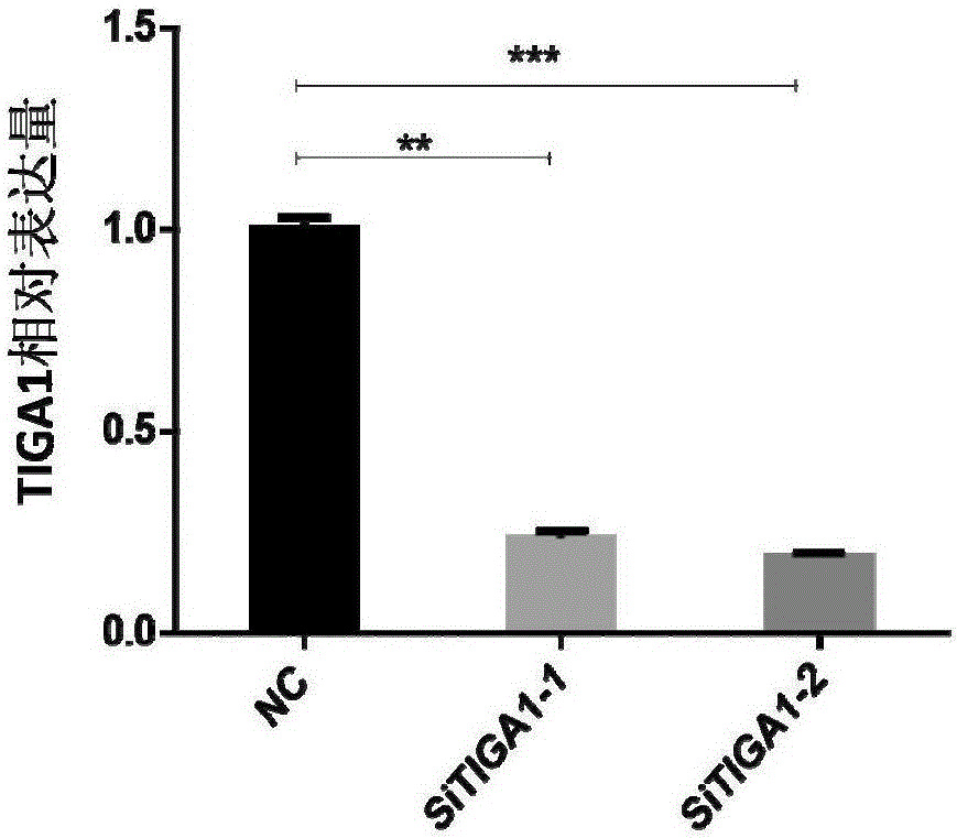 Method for enhancing anti-cervical cancer activity of glutaminase enzyme inhibitor by taking TIGA1 (Transcript Induced by Growth Arrest 1) as target spot