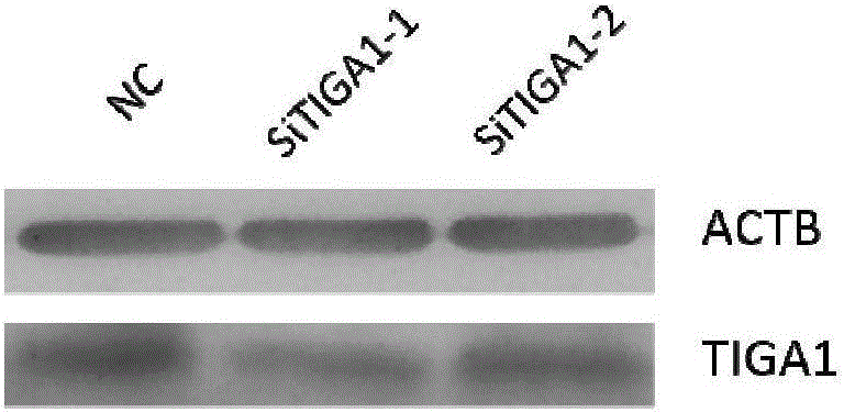 Method for enhancing anti-cervical cancer activity of glutaminase enzyme inhibitor by taking TIGA1 (Transcript Induced by Growth Arrest 1) as target spot