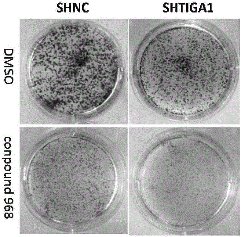 Method for enhancing anti-cervical cancer activity of glutaminase enzyme inhibitor by taking TIGA1 (Transcript Induced by Growth Arrest 1) as target spot