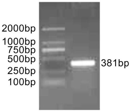 OTOF gene mutation detection kit related to auditory neuropathy spectrum disorder