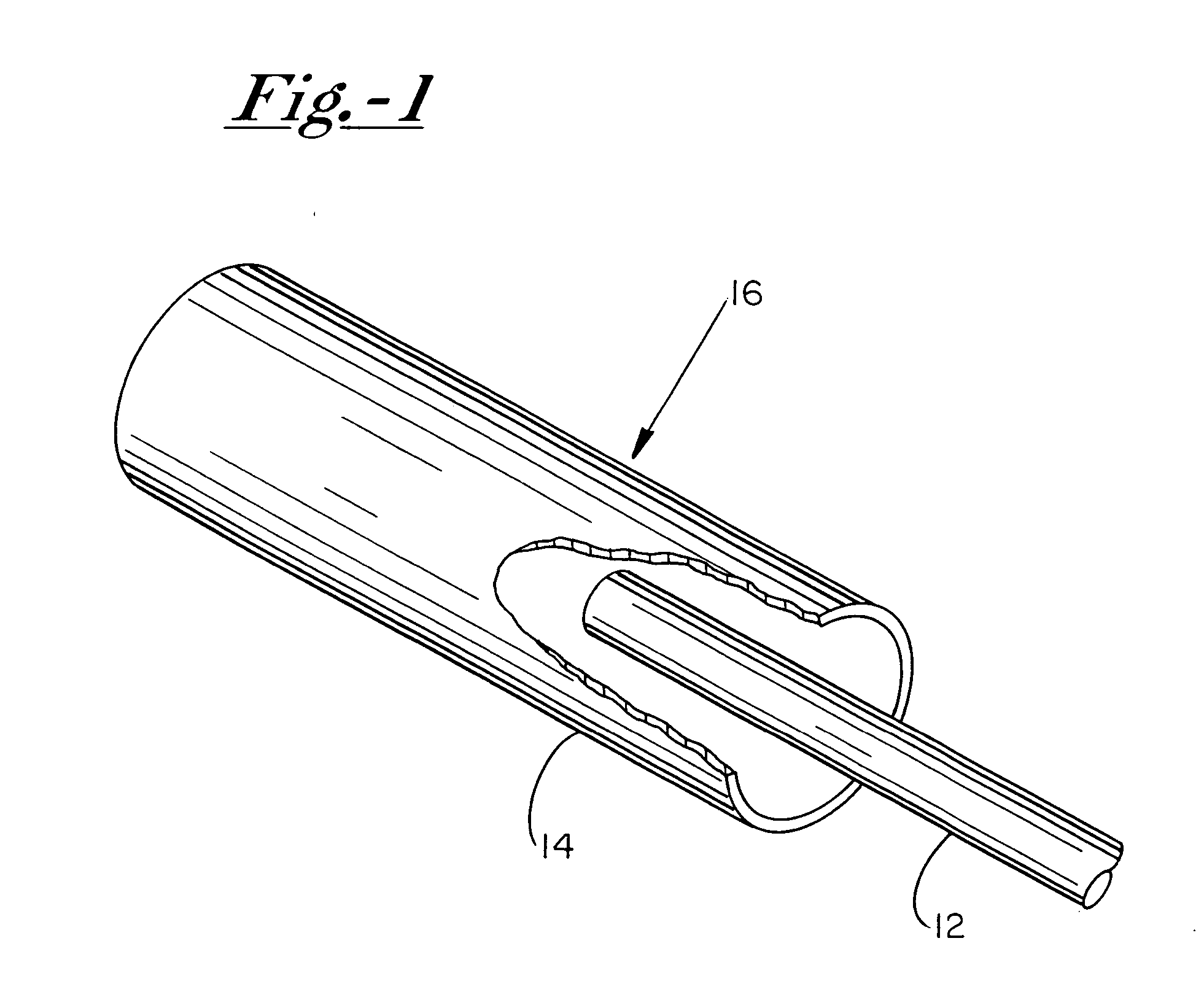 Multiple layer coating composition