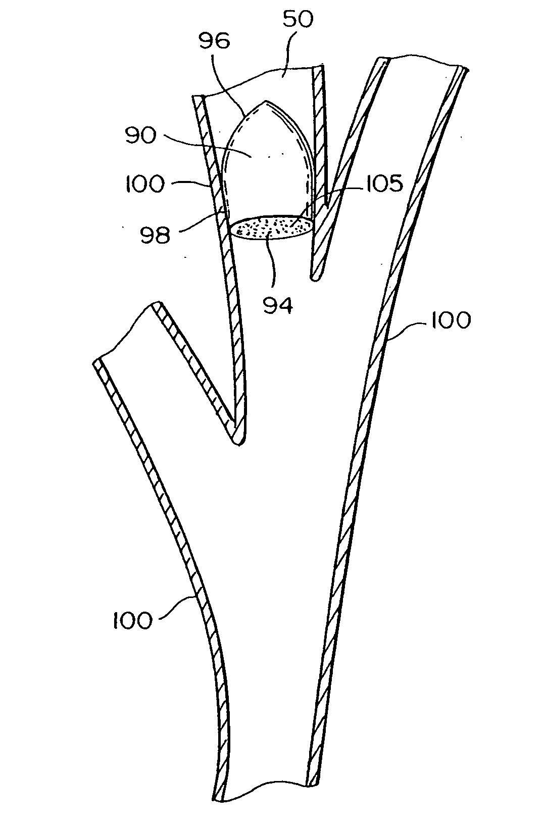 Intra-bronchial obstruction device that provides a medicant intra-bronchially to the patient