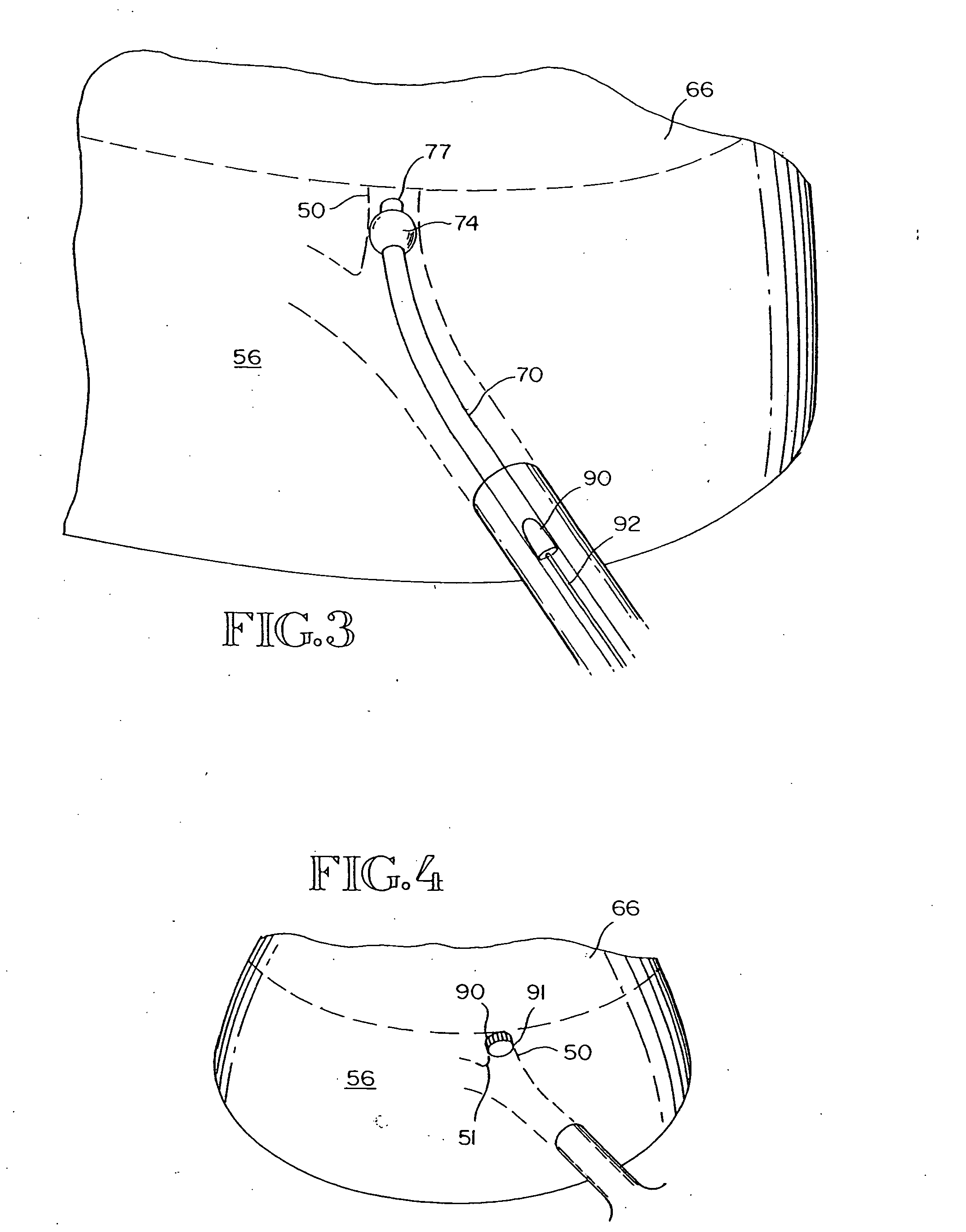 Intra-bronchial obstruction device that provides a medicant intra-bronchially to the patient