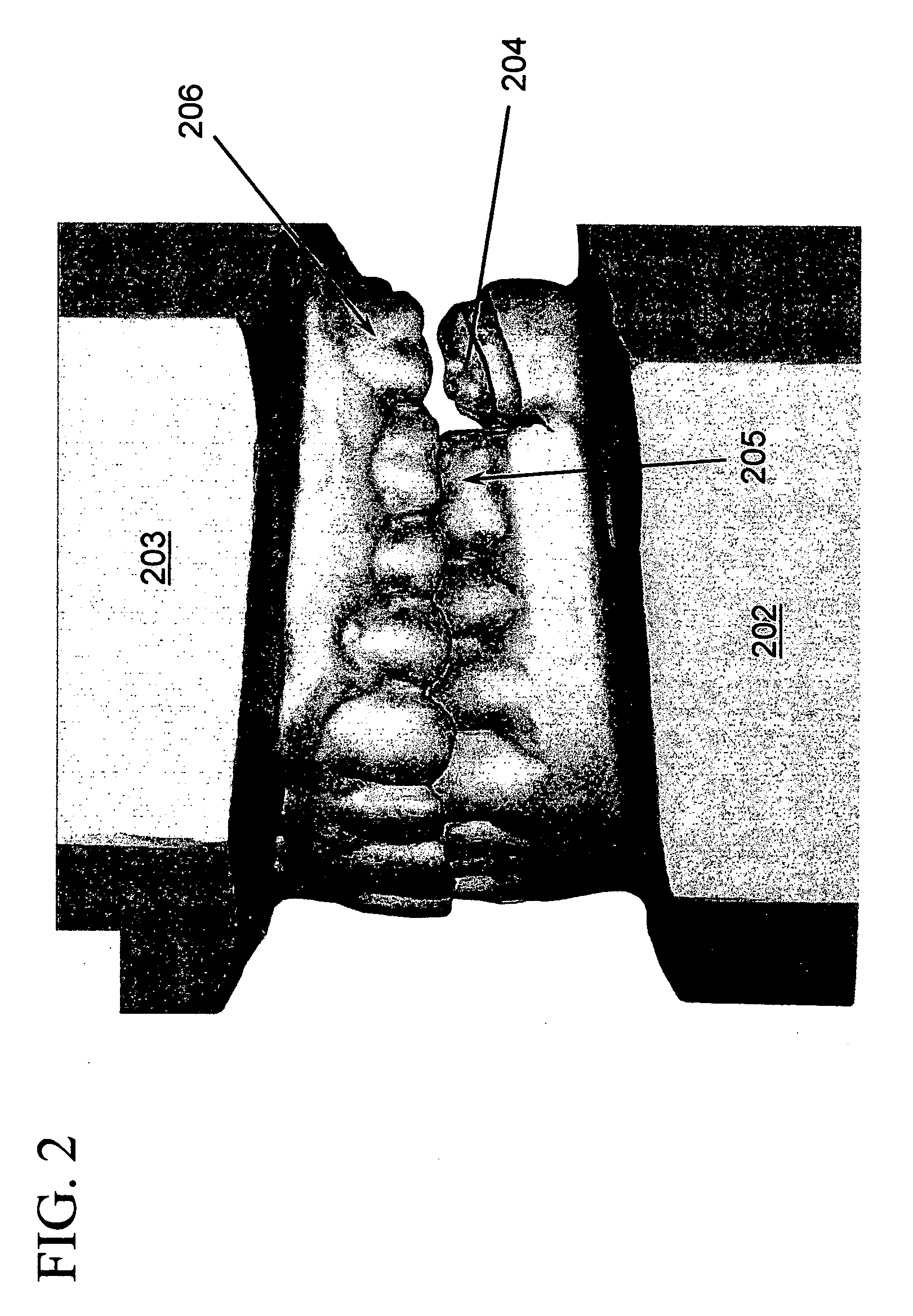 Multi-component dental appliances and a method for constructing the same