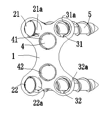 Lower cervical spine anterior pedicle screw matching, fixing and retaining device