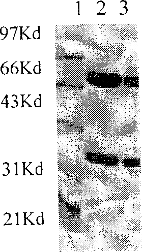 Antigen simulating epipeptide of C type para chicken blood phili bacillus and its use