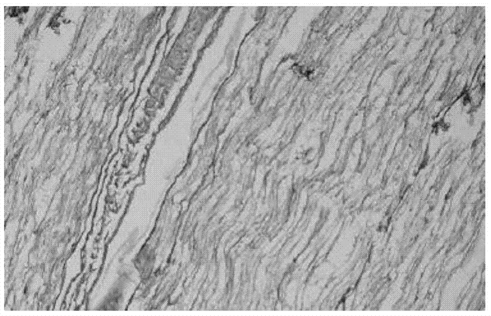 Preparation method for tissue engineering nerves of compound seed cells