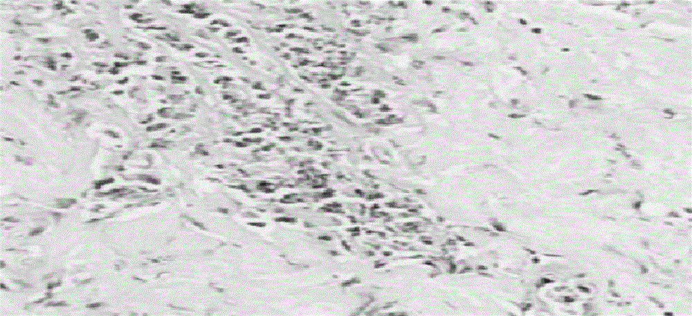 Traditional Chinese medicinal jelly for treating recurrent oral ulcers and preparation method thereof