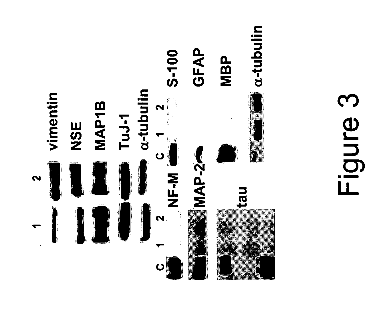 Directed in vitro differentiation of marrow stromal cells into neural cell progenitors