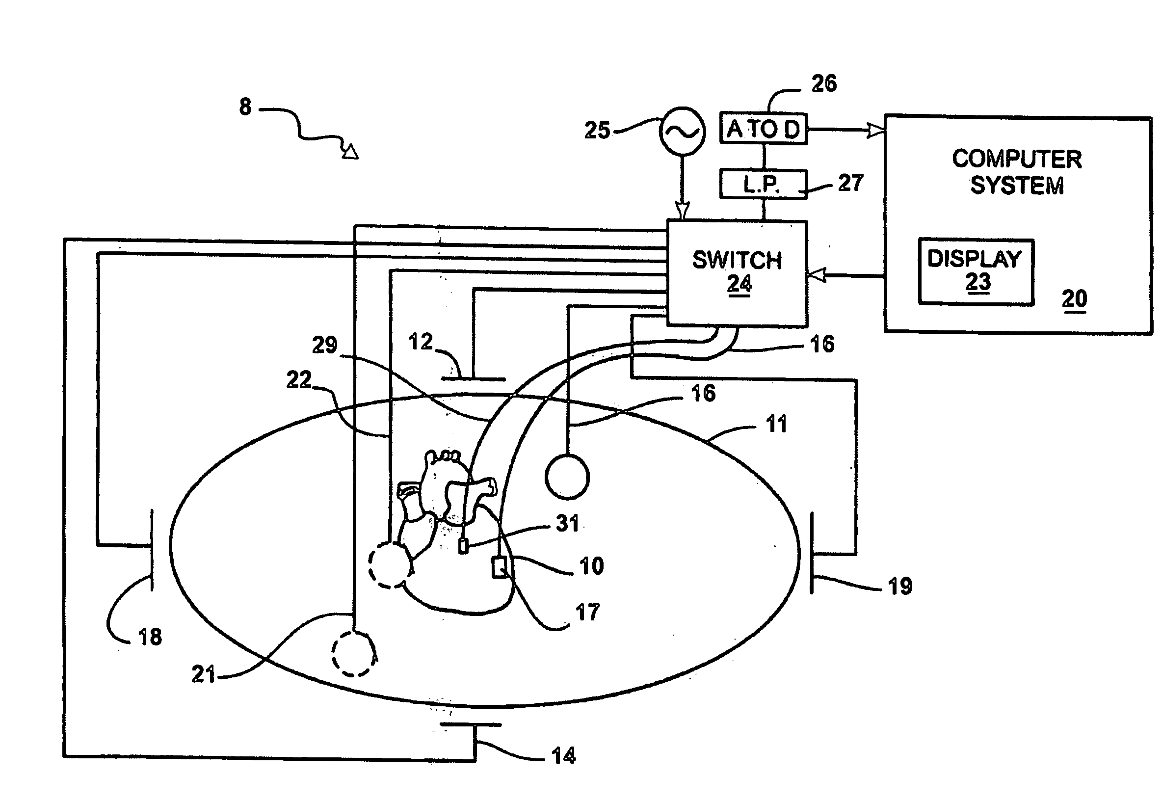 System and method for complex geometry modeling of anatomy using multiple surface models