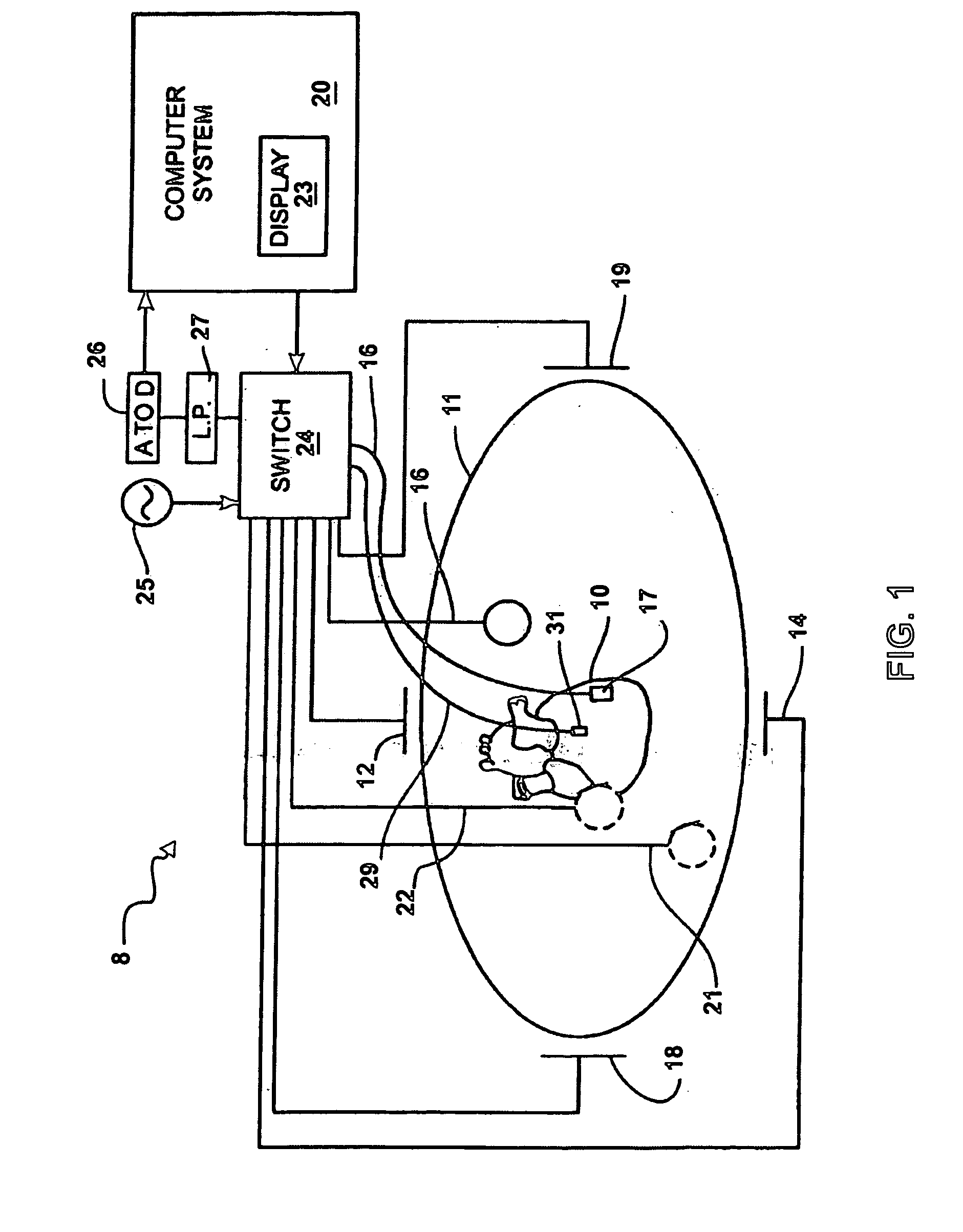 System and method for complex geometry modeling of anatomy using multiple surface models