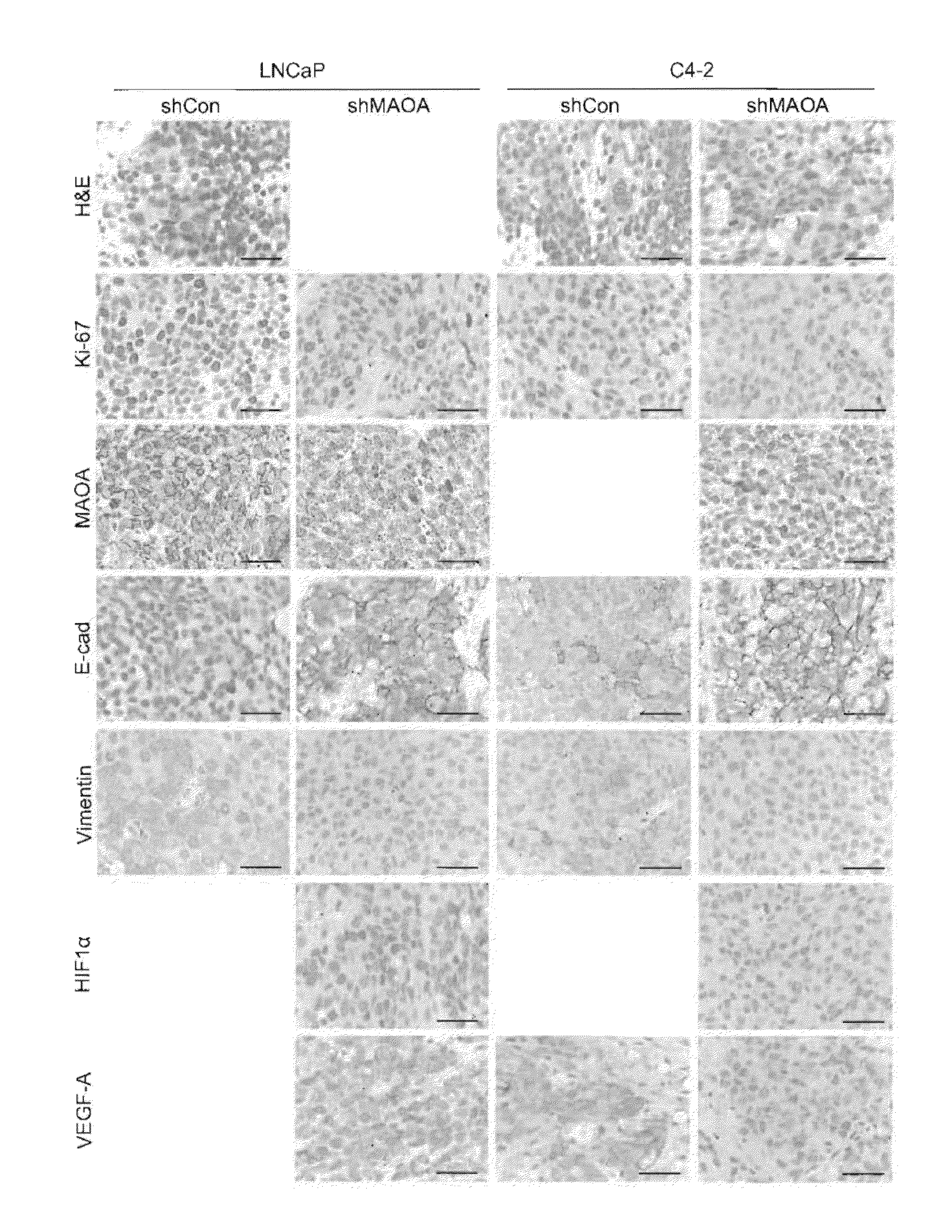 Monoamine oxidase inhibitors and methods for treatment and diagnosis of prostate cancer