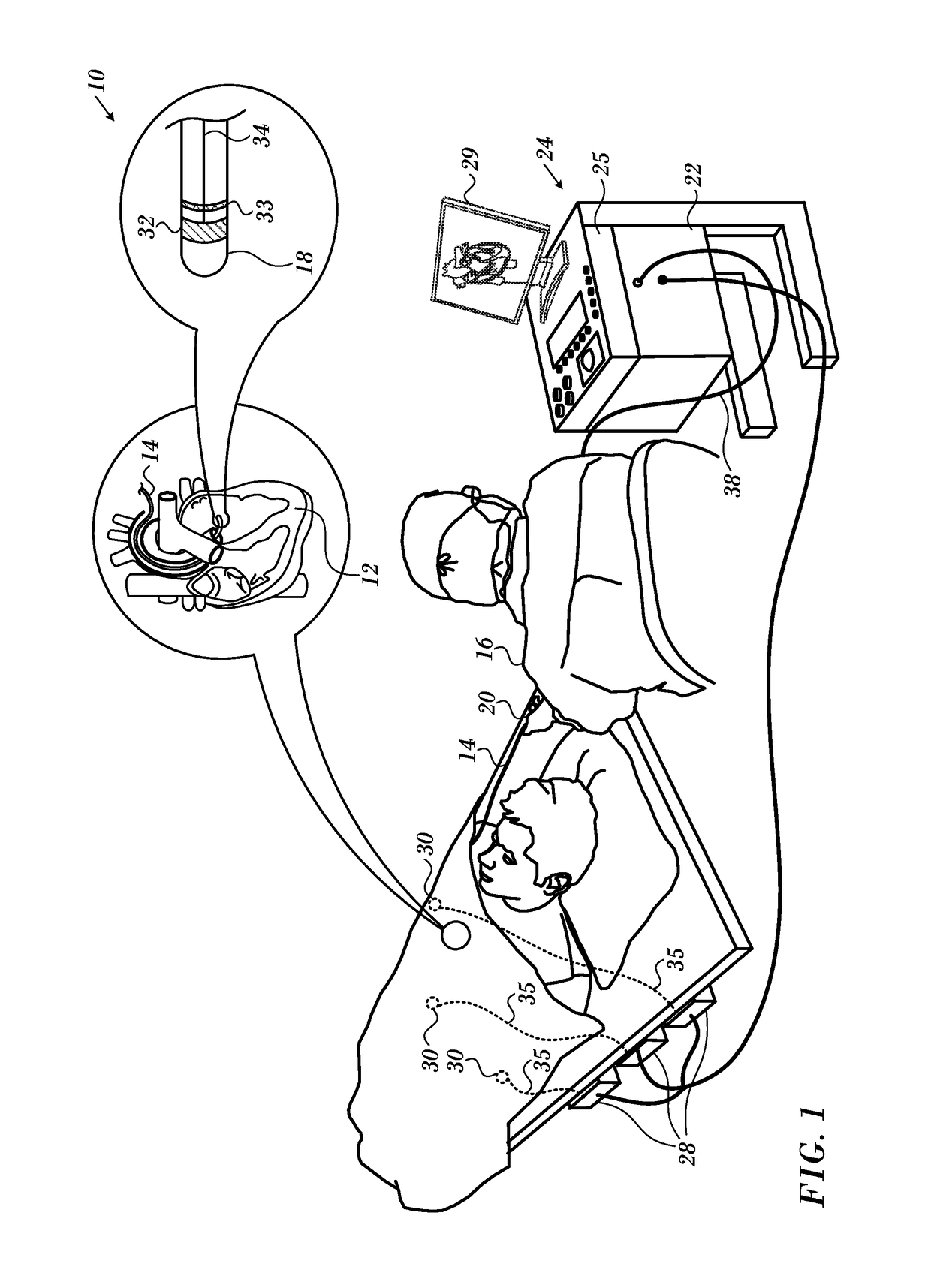 Registration maps using intra-cardiac signals