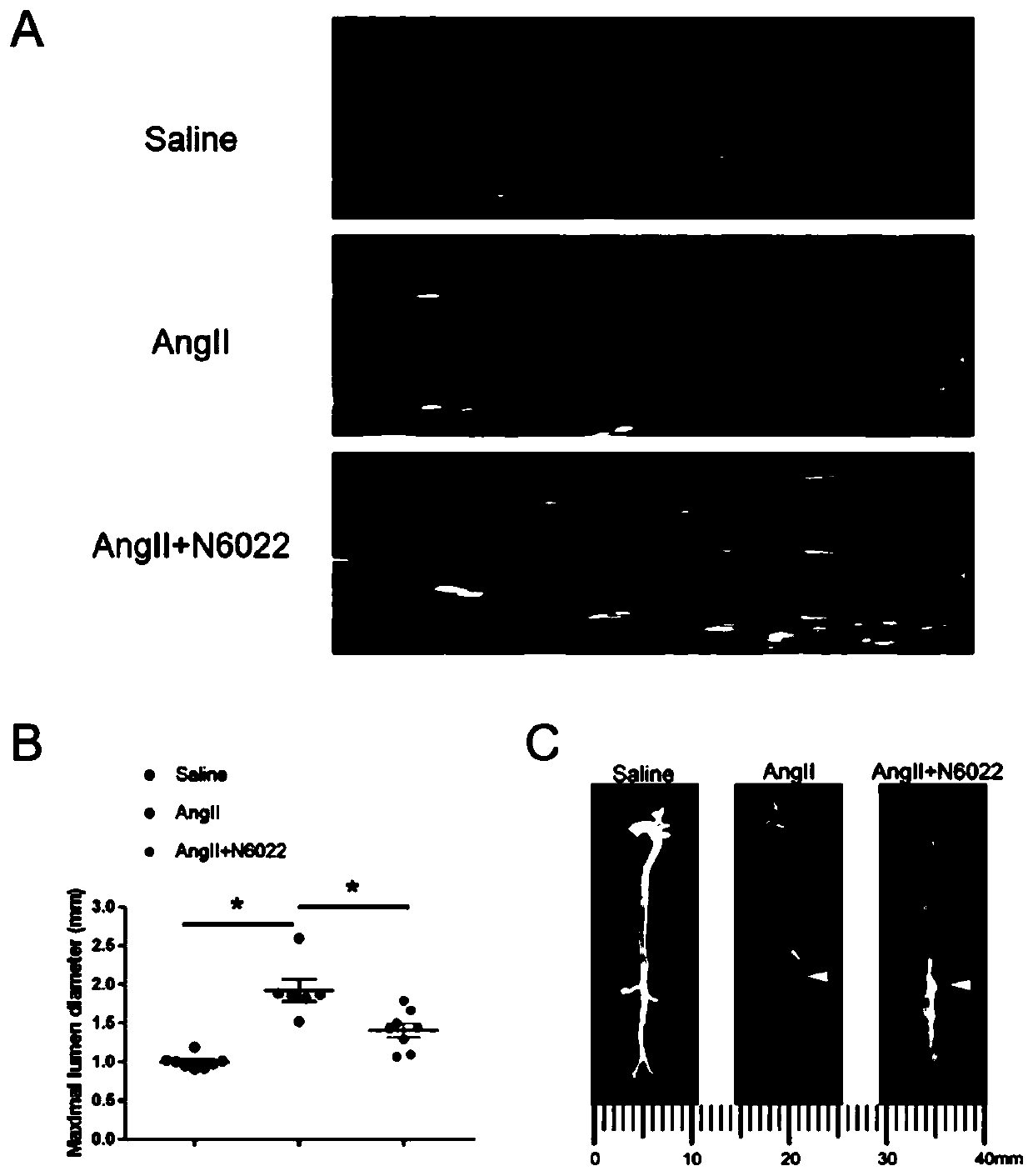 Application of N6022 in prevention and treatment of aortic dissection and aortic aneurysm