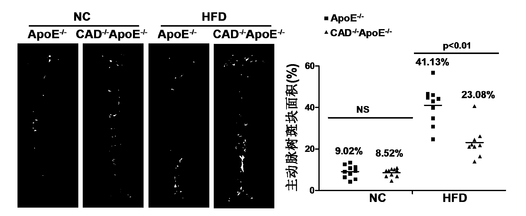 Functions and applications of nucleotide synthetase CAD in treatment of atherosclerosis