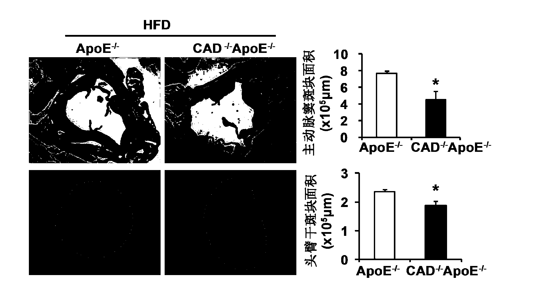 Functions and applications of nucleotide synthetase CAD in treatment of atherosclerosis