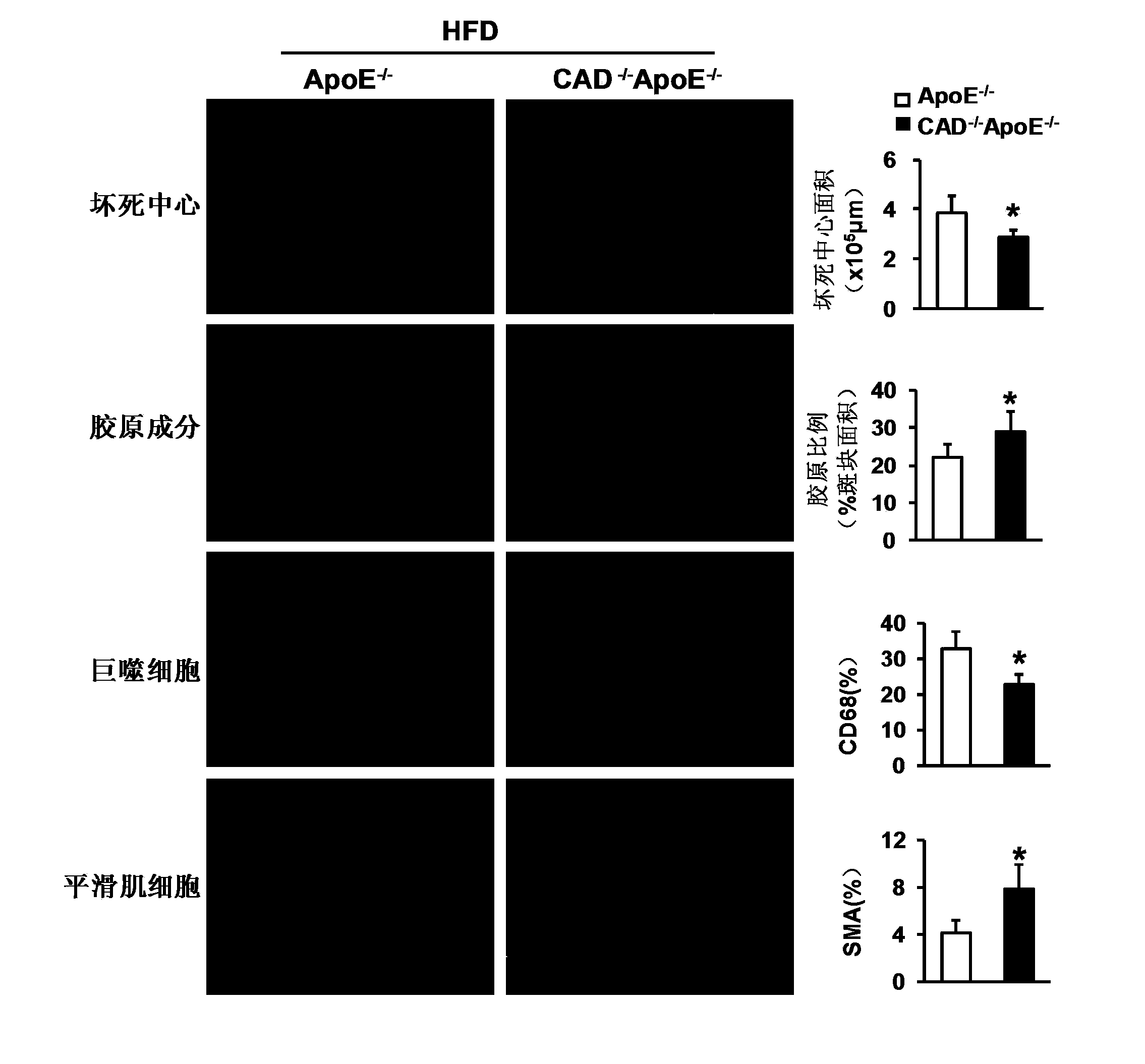 Functions and applications of nucleotide synthetase CAD in treatment of atherosclerosis