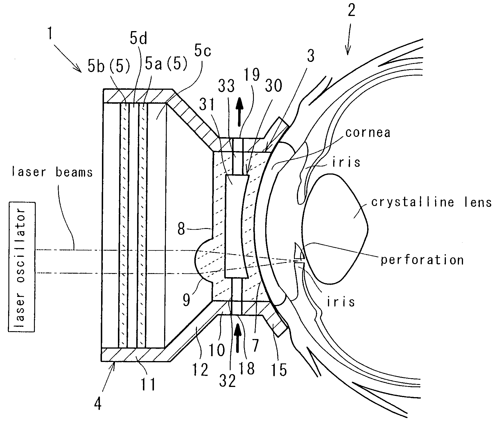 Ophthalmic laser treatment device