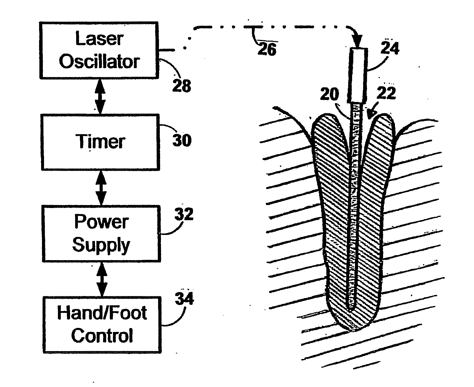 Instrument for Delivery of Optical Energy to the Dental Root Canal System for Hidden Bacterial and Live Biofilm Thermolysis