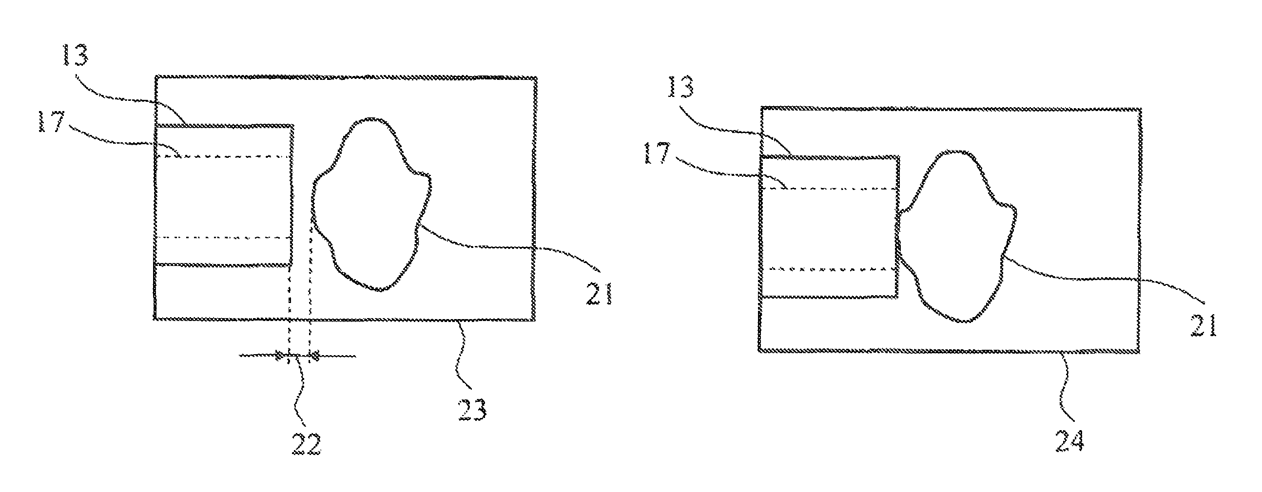 Ophthalmic surgical system and control arrangement therefor