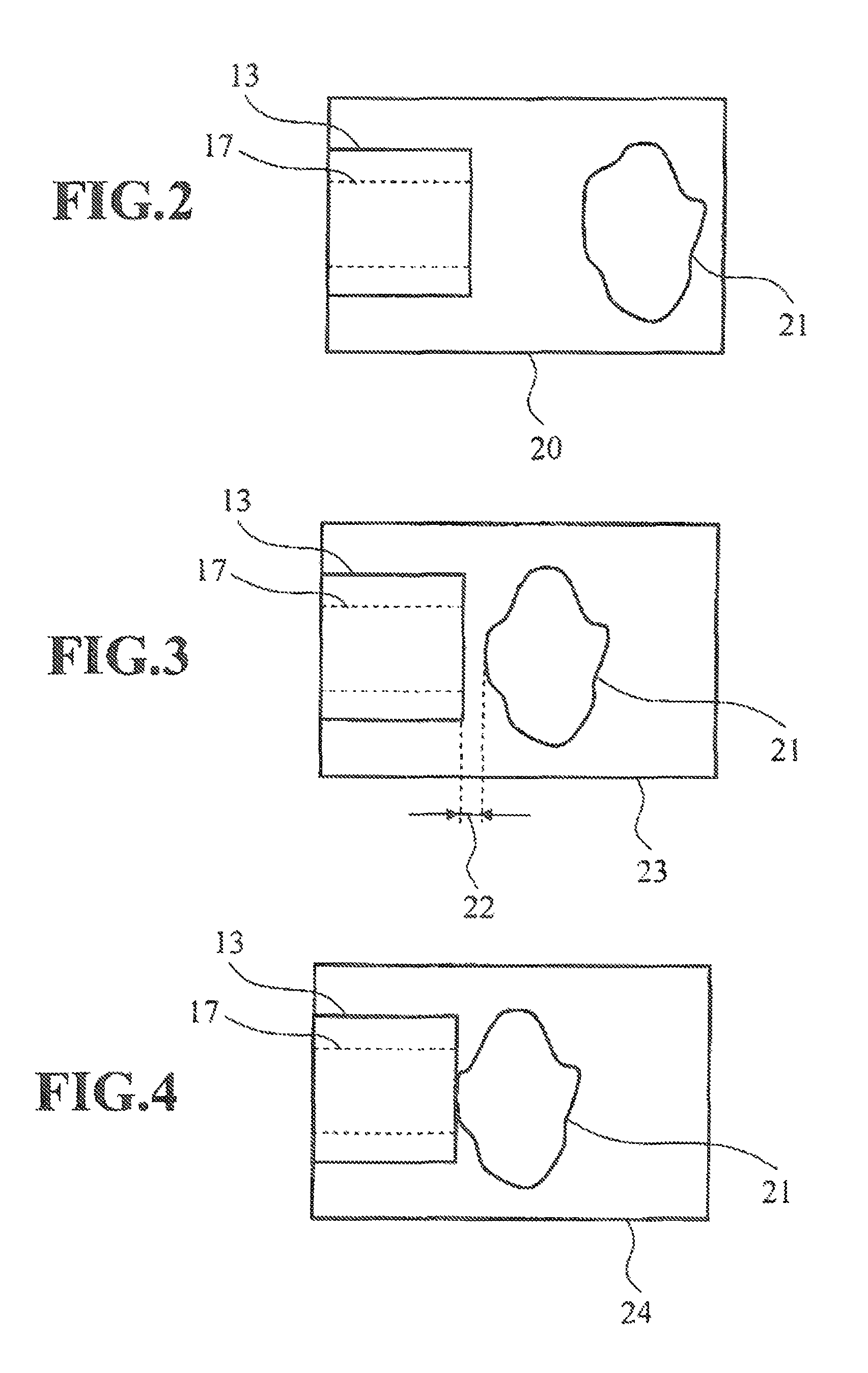 Ophthalmic surgical system and control arrangement therefor