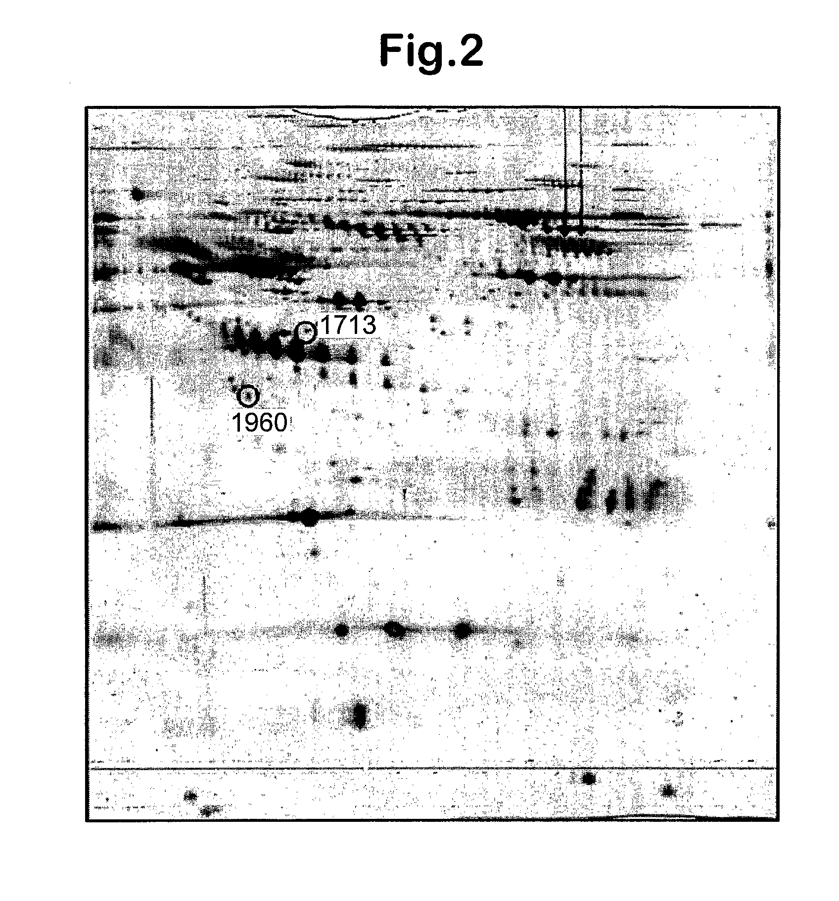 Methods and compositions for monitoring progression of huntington's disease