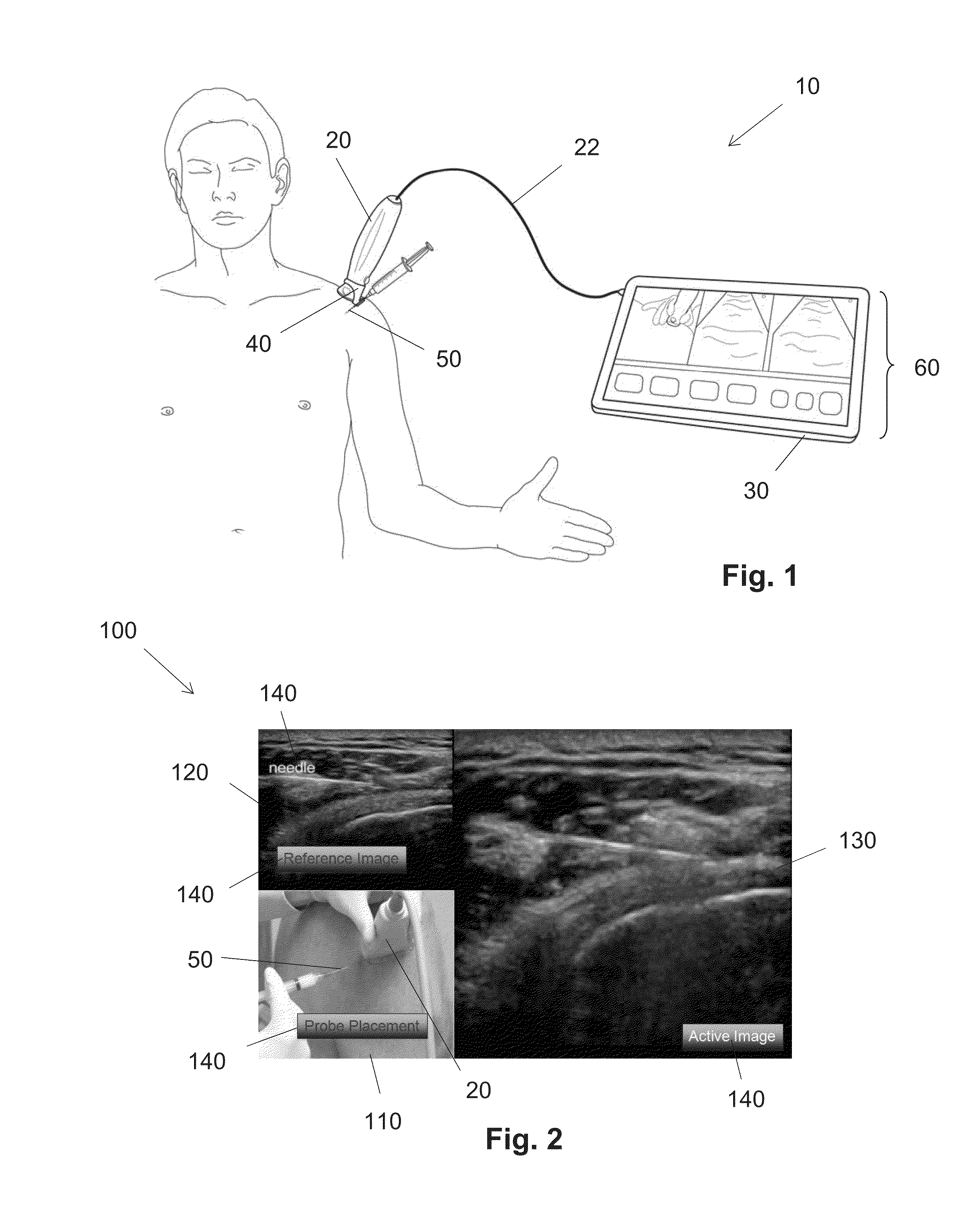 Image system for percutaneous instrument guidence