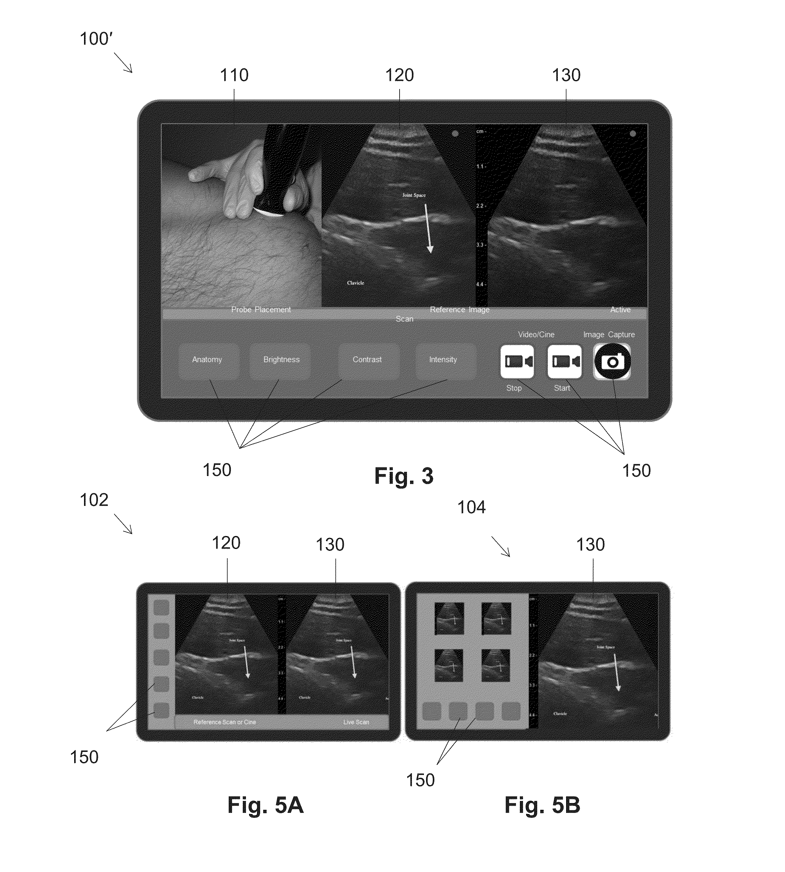 Image system for percutaneous instrument guidence