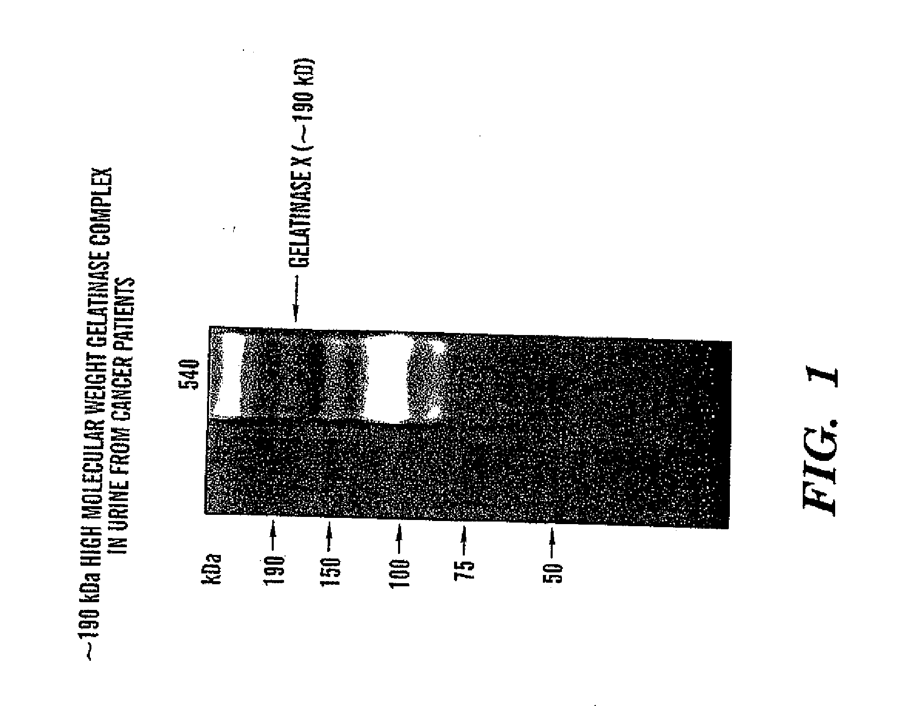 Adamts-7 as a biomarker for cancers of epithelial origin