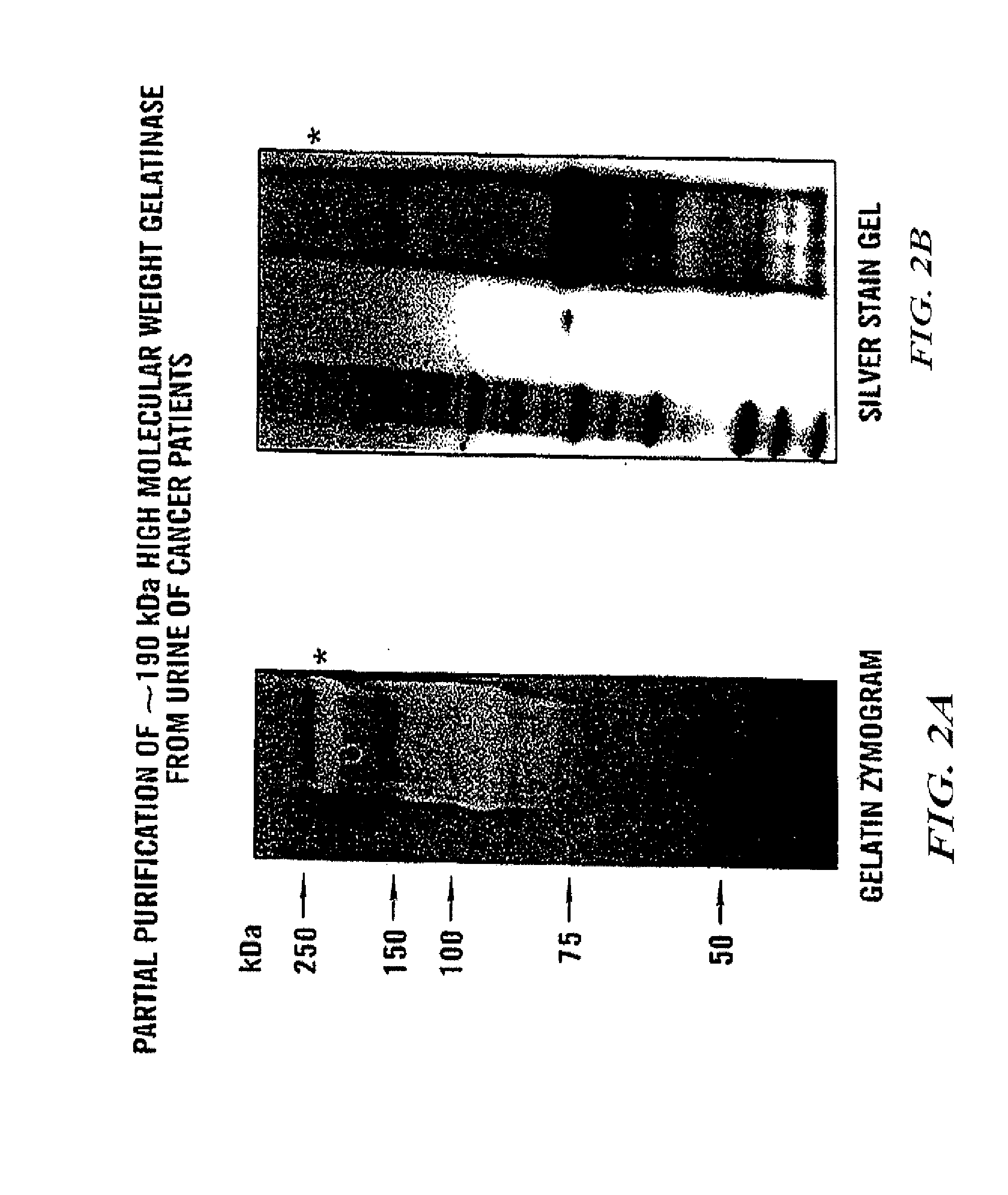 Adamts-7 as a biomarker for cancers of epithelial origin