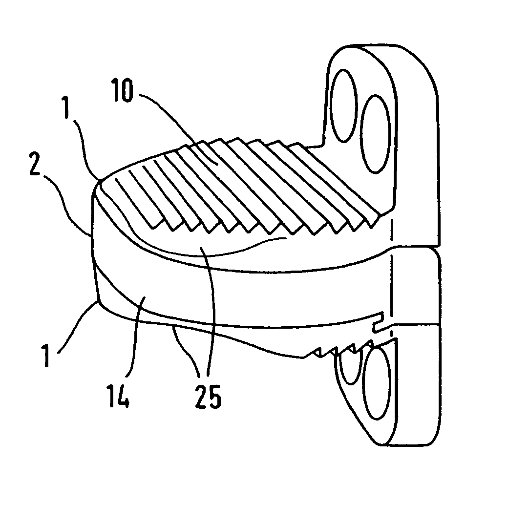 Method for implanting an intervertebral disk prosthesis