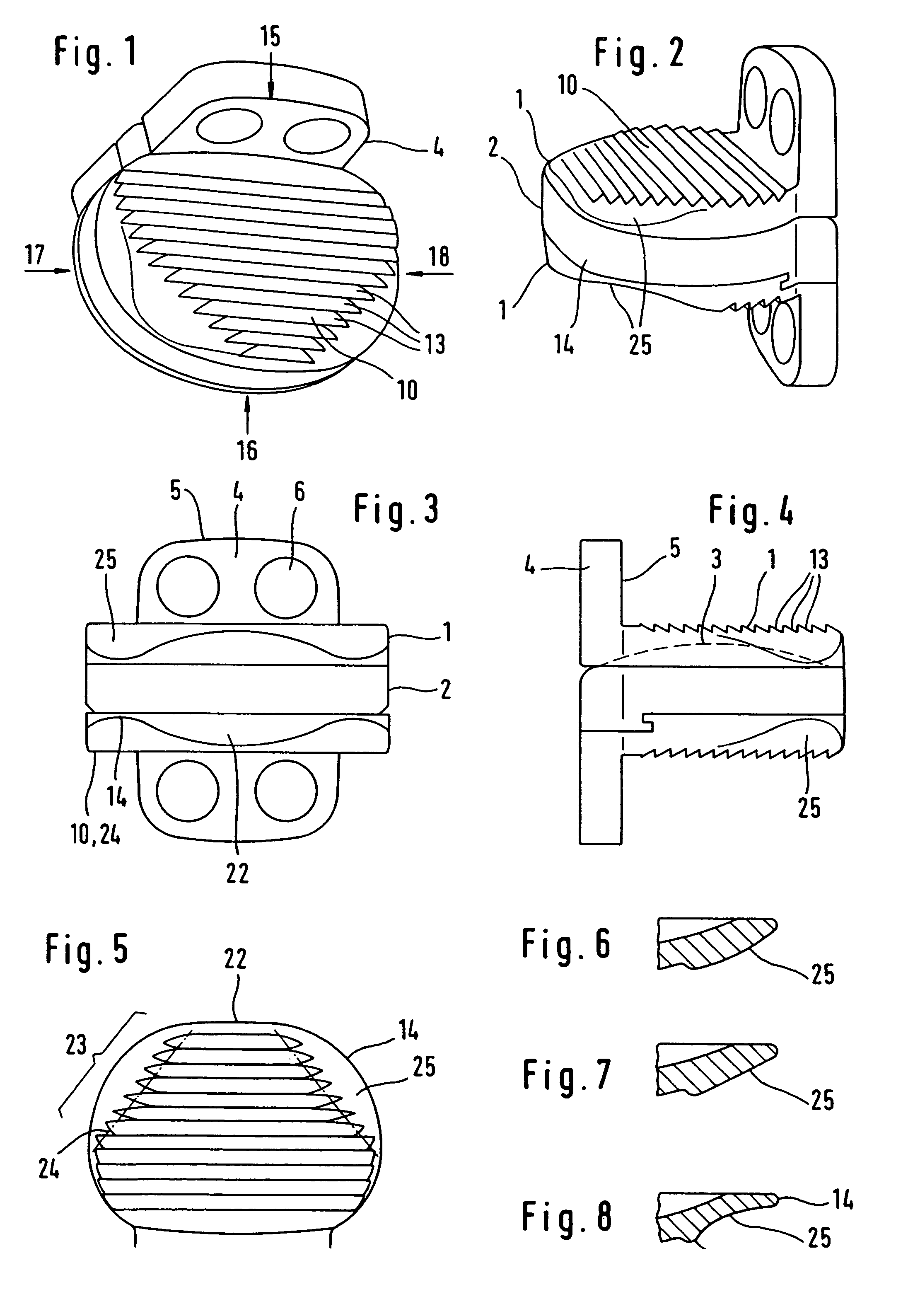 Method for implanting an intervertebral disk prosthesis