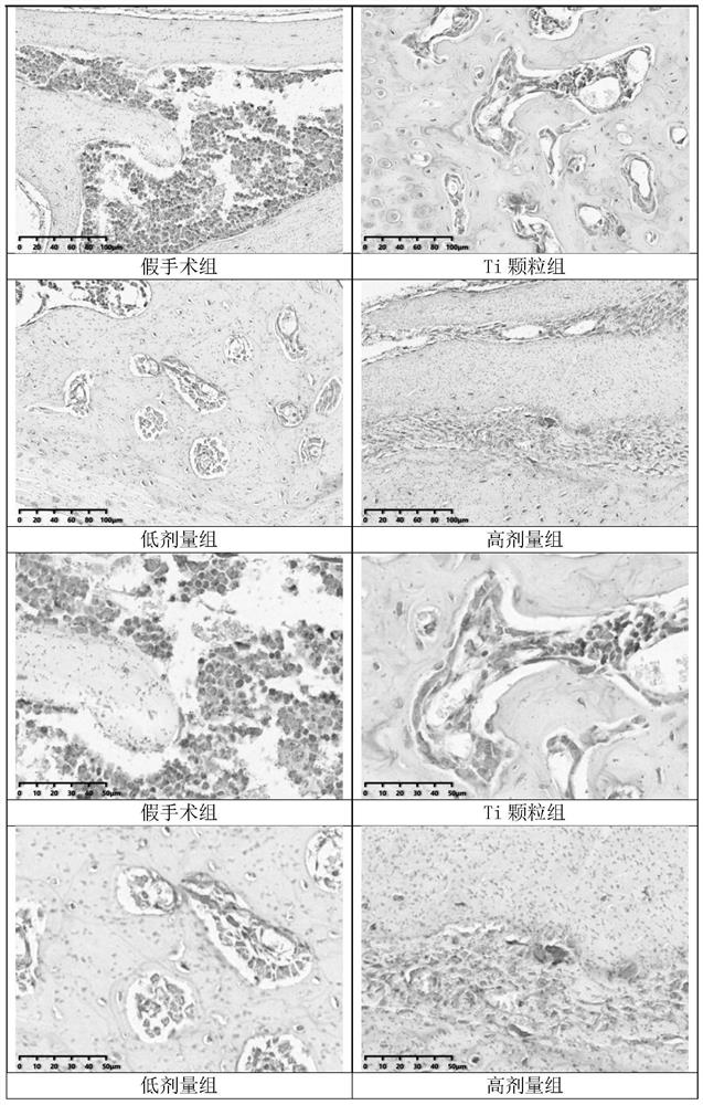 Application of curculigoside in preparation of medicines for treating periprosthetic osteolysis