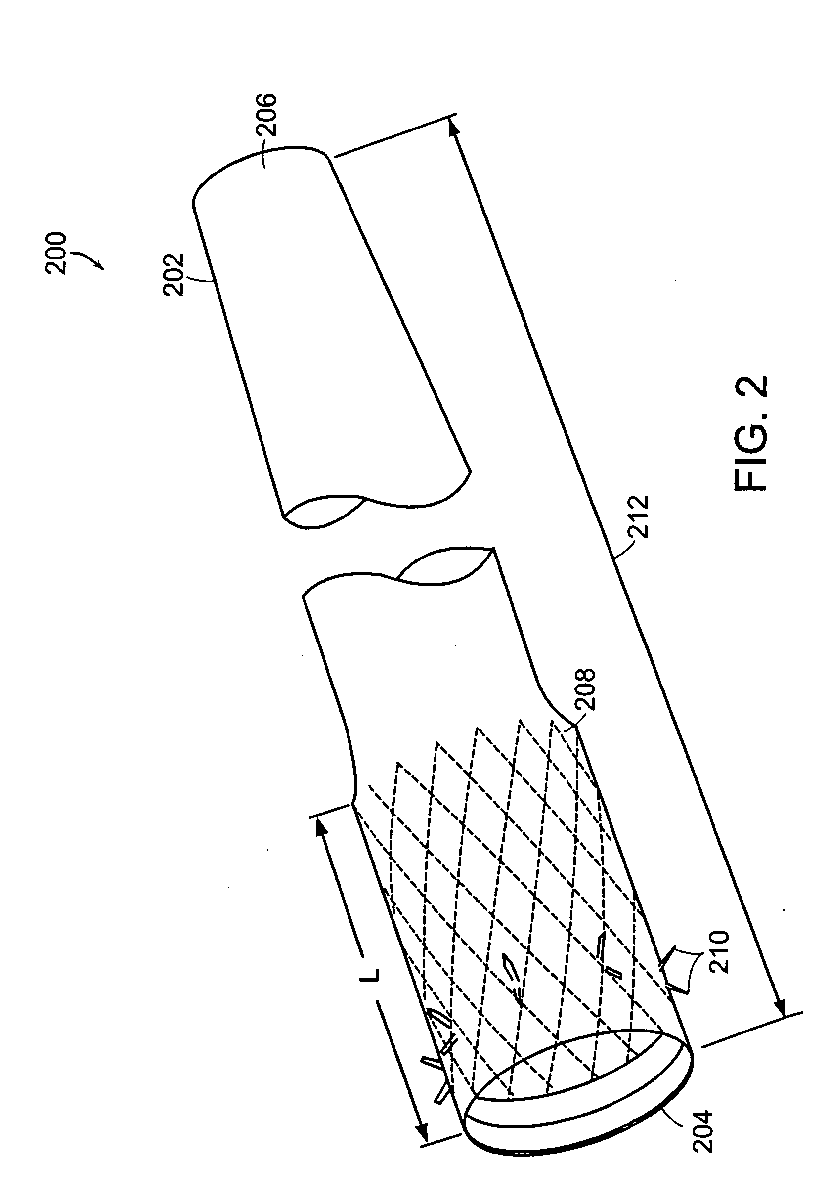 Bariatric sleeve removal devices