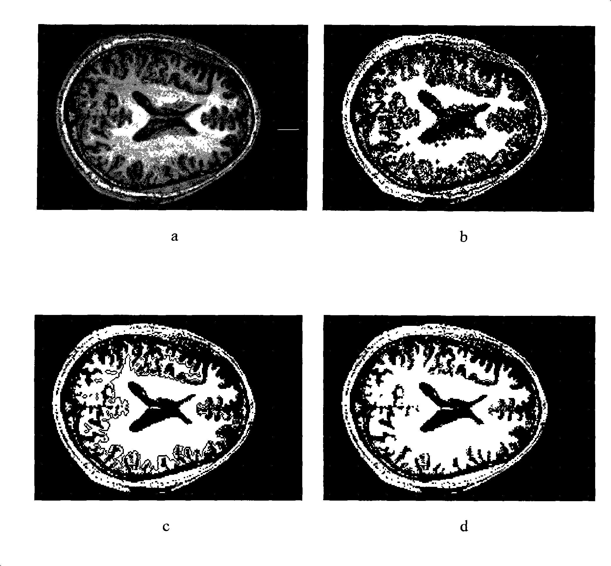 Method of image segmentation based on area upgrowth and ant colony clustering