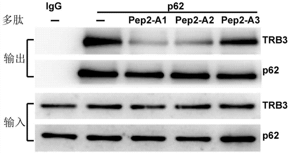 Application of a polypeptide in the preparation of drugs for treating diabetic cardiomyopathy