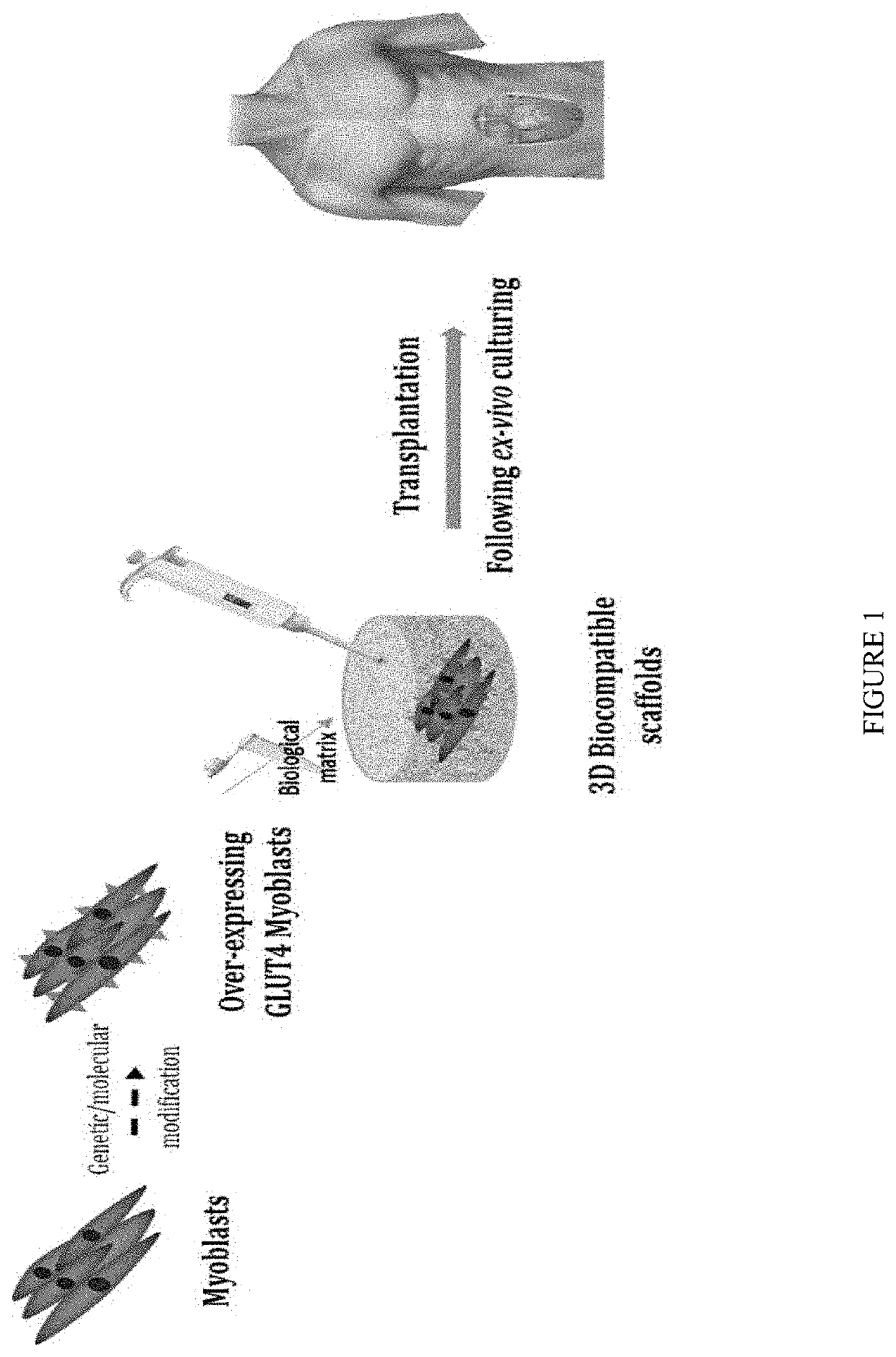 Methods and compositions for treating and preventing diabetes