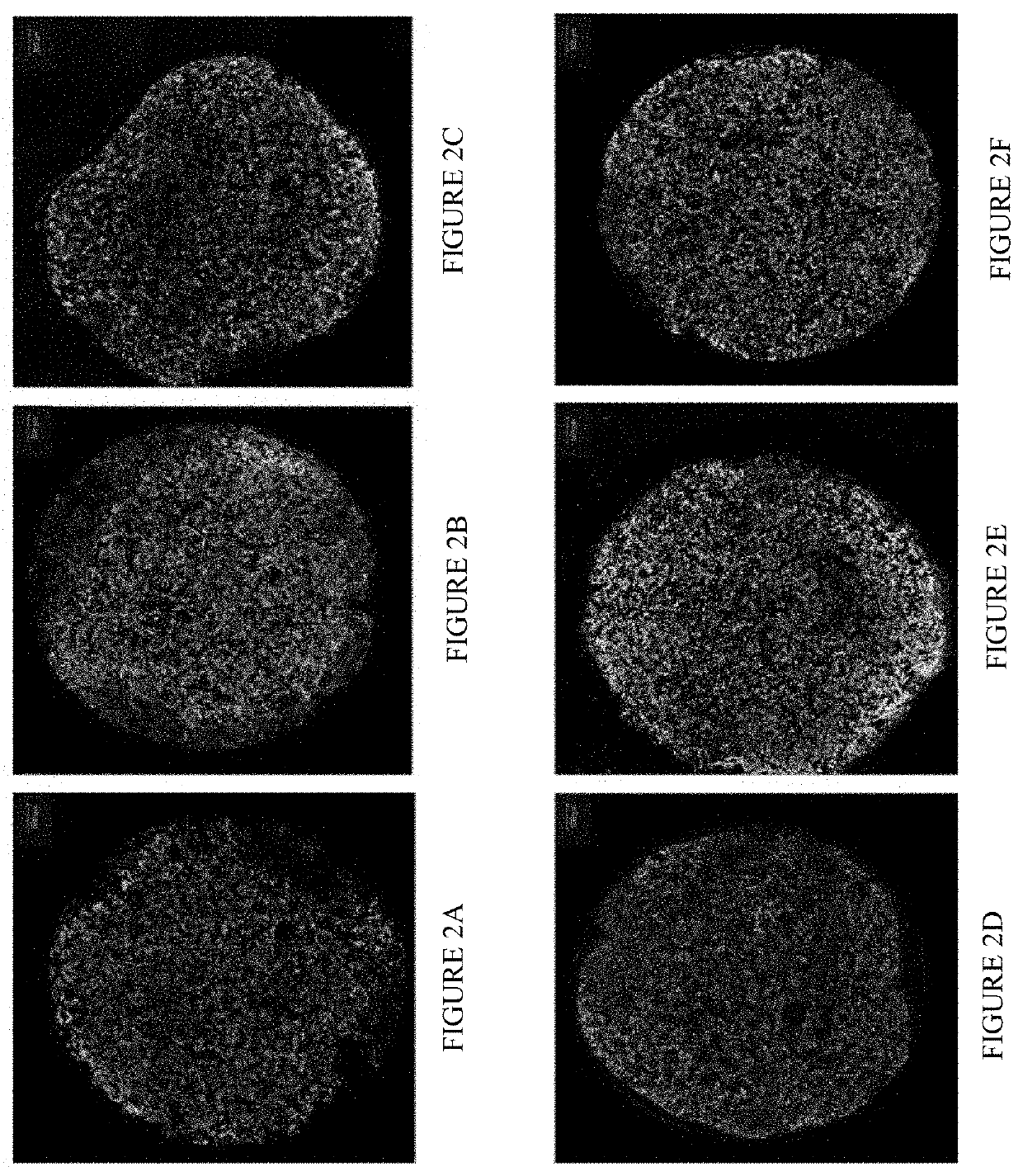 Methods and compositions for treating and preventing diabetes