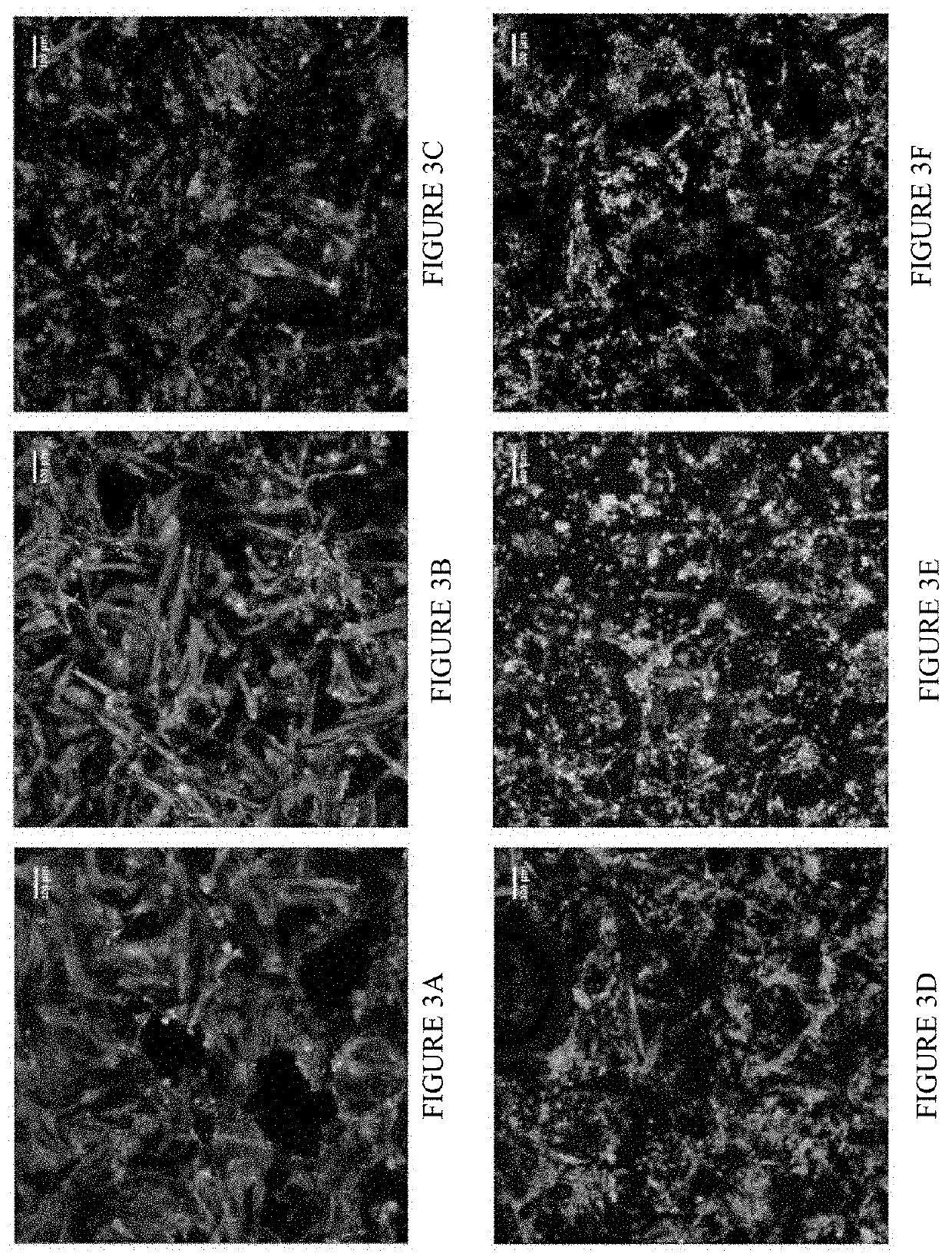 Methods and compositions for treating and preventing diabetes