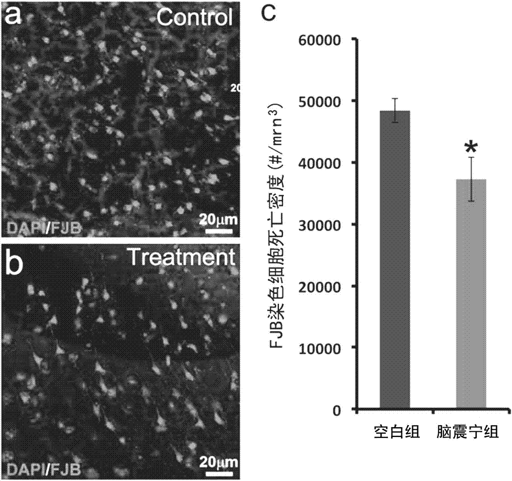 New pharmaceutical use of Naozhenning preparation