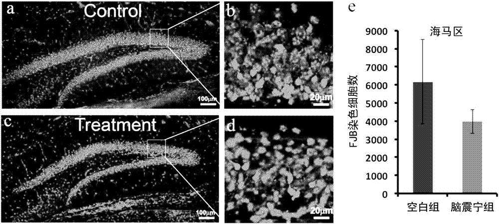 New pharmaceutical use of Naozhenning preparation