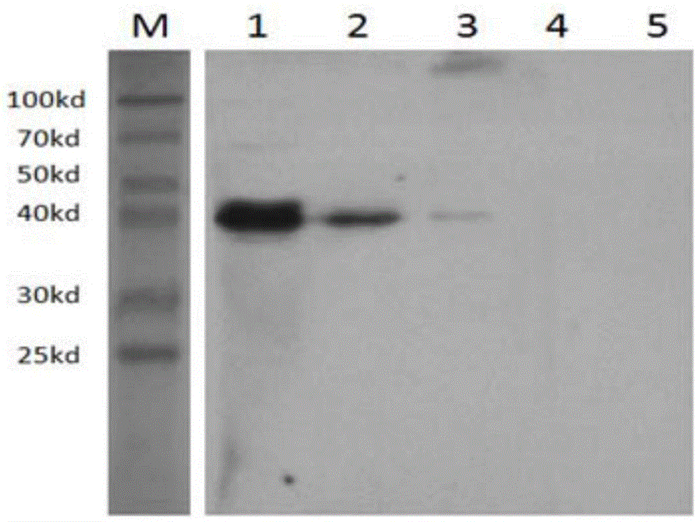 Apolygus lucorum soluble trehalase (AlTre-1) monoclonal antibody as well as preparation method and application of thereof